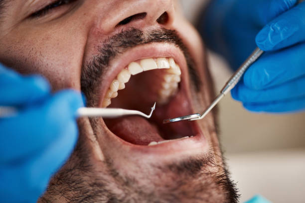 TMJ/TMD Treatment in Meridian Hills, IN